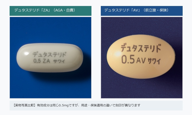 デュタステリドZAとAVの実物写真比較（適応外使用の解説）